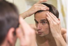 Hair Transplants for Thinning Hair: When to Consider Treatment