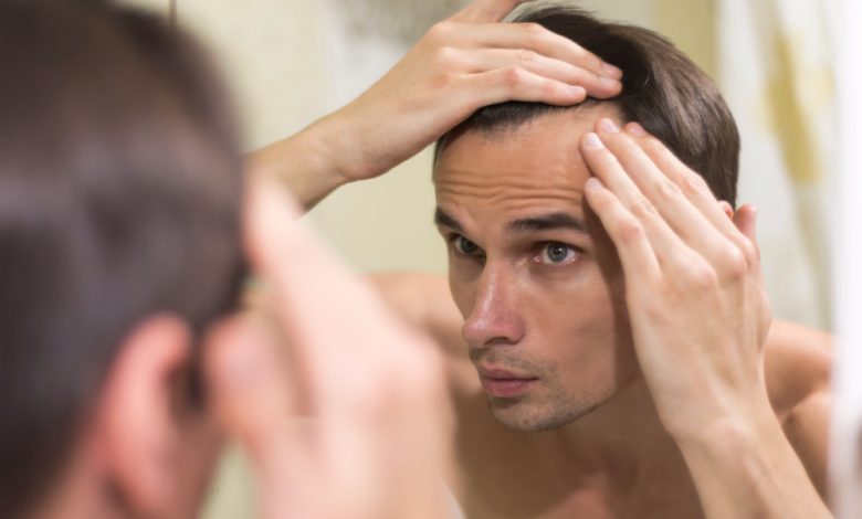 Hair Transplants for Thinning Hair: When to Consider Treatment