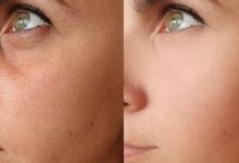How Can I Find A Qualified Botox Injections In Tucson